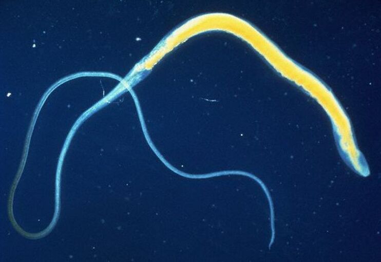 O tricocéfalo é un parasito intestinal común.