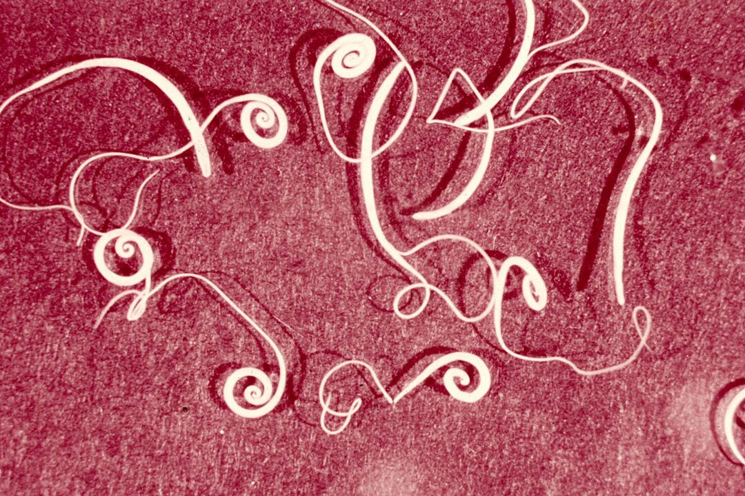 vermes humanos Trichinella